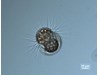 Photo of Mesodinium rubrum